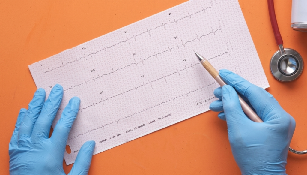 El Monitoreo Holder como prevención integral