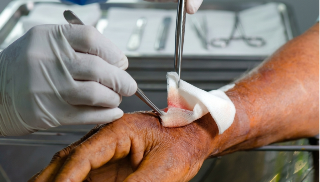 Gasas no estériles en el cuidado de heridas