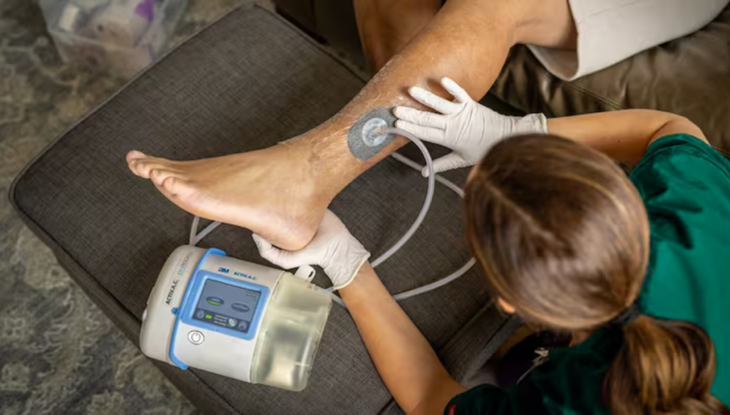 Terapia VAC para heridas y recuperación integral