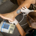 Terapia VAC para heridas y recuperación integral