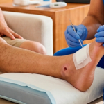Úlceras por presión: cómo identificarlas, prevenir complicaciones y favorecer la recuperación