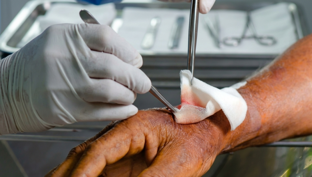 Heridas infectadas: señales que requieren atención inmediata