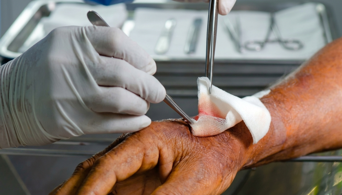 Heridas infectadas: señales que requieren atención inmediata