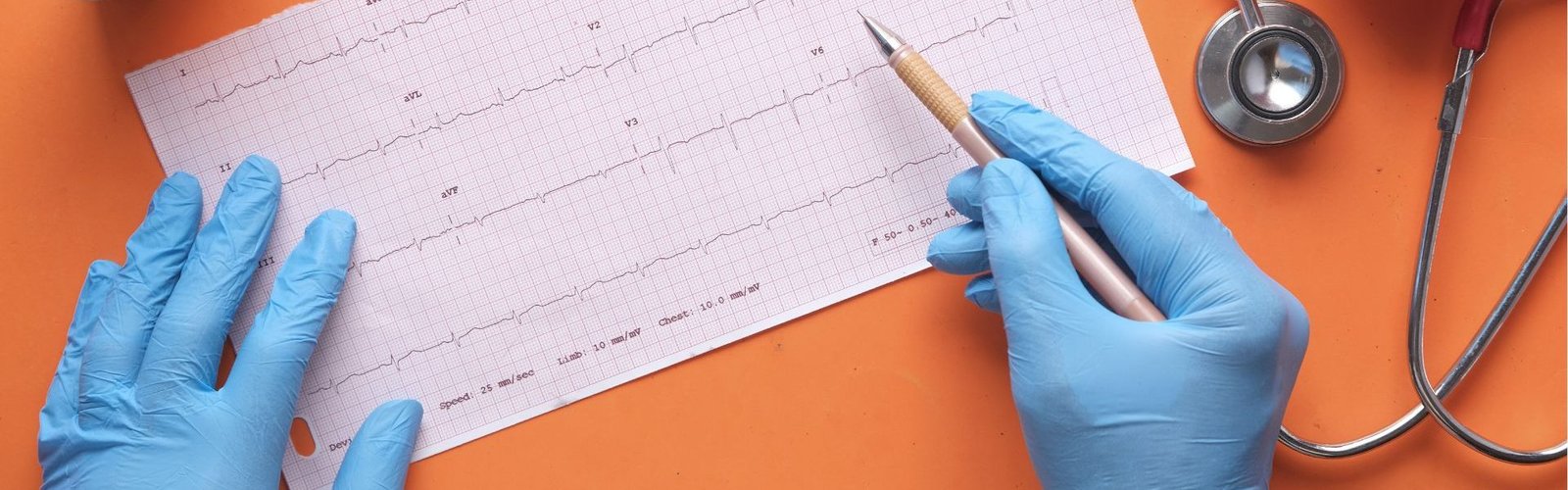 Monitoreo Holter y Electrocardiograma