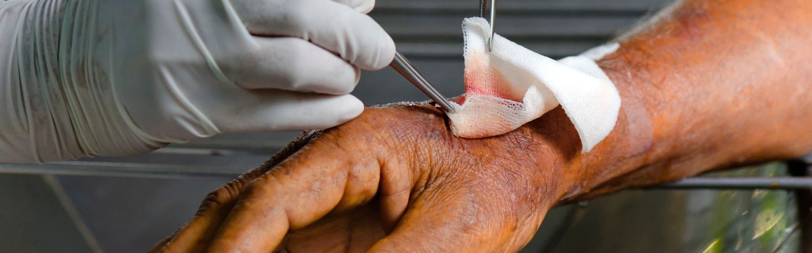 clinica de heridas 2