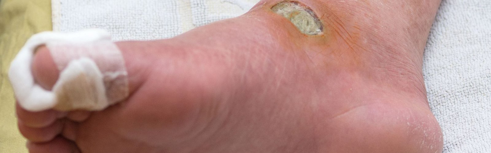 clinica de heridas 3