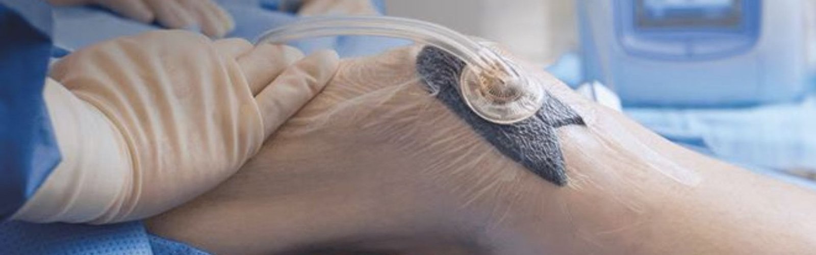 clinica de heridas 4